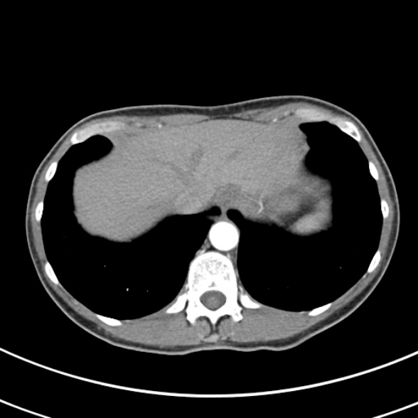 File:Normal multiphase CT liver (Radiopaedia 38026-39996 B 9).jpg