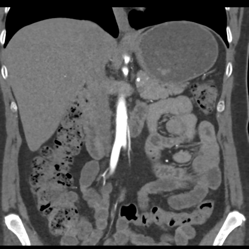 File:Normal CT renal artery angiogram (Radiopaedia 38727-40889 B 37).png