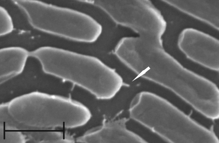 Needle-like structures on surface of Aeromonas hydrophila (MPU A541 cells)