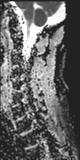 File:Normal MRI cervical spine (infection protocol) (Radiopaedia 53916-60039 Sagittal 9).png