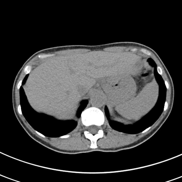 File:Normal multiphase CT liver (Radiopaedia 38026-39996 Axial non-contrast 11).jpg