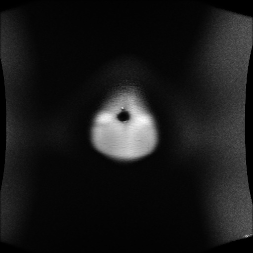 File:Normal MRI abdomen in pregnancy (Radiopaedia 88001-104541 Coronal T2 1).jpg