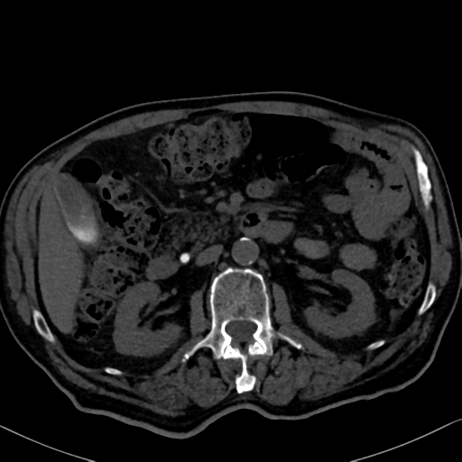 File:Normal CT intravenous cholangiogram (Radiopaedia 38199-40208 Axial IVC 48).png