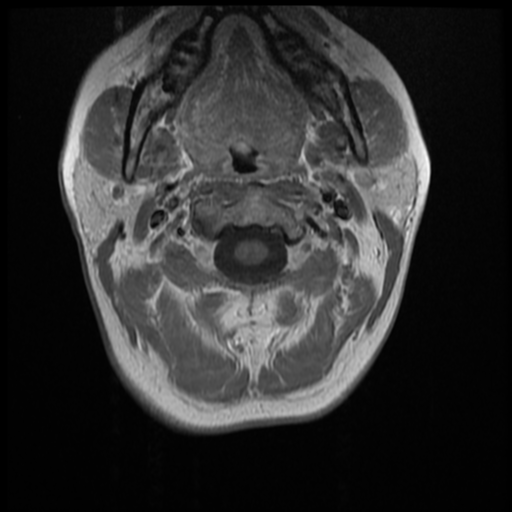 File:Normal cervical and thoracic spine MRI (Radiopaedia 35630-37156 Axial T1 C+ 28).png