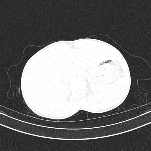 File:Arteria lusoria (Radiopaedia 88528-105192 Axial lung window 58).jpg