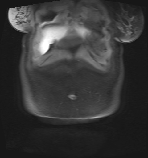 File:Normal hepatobiliary phase liver MRI (Radiopaedia 58968-66230 B 49).jpg
