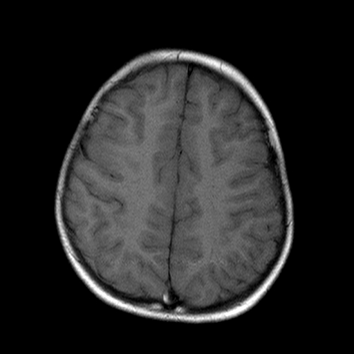File:Brainstem ganglioglioma (Radiopaedia 10763-11224 Axial T1 5).jpg