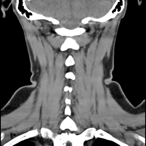 File:Normal cervical spine MRI (including Dixon) (Radiopaedia 42762-45926 Axial non-contrast 1).png
