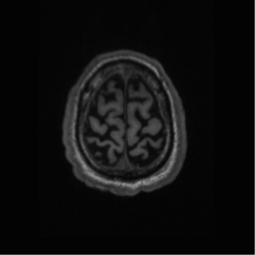 Alzheimer disease - probable (Radiopaedia 35334-36837 Axial T1 66).png