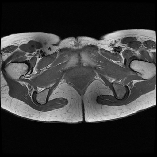File:Normal female pelvis MRI (retroverted uterus) (Radiopaedia 61832-69933 Axial T1 27).jpg