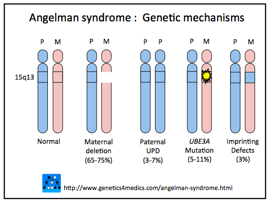 File:Angelman syndrome genetics (DermNet NZ 9579841Angelman-orig).png