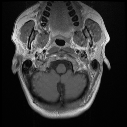 File:Normal cervical and thoracic spine MRI (Radiopaedia 35630-37156 Axial T1 C+ 33).png