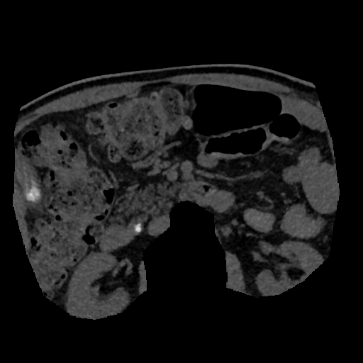 File:Normal CT intravenous cholangiogram (Radiopaedia 38199-40208 Axial IVC (MIP) 11).png