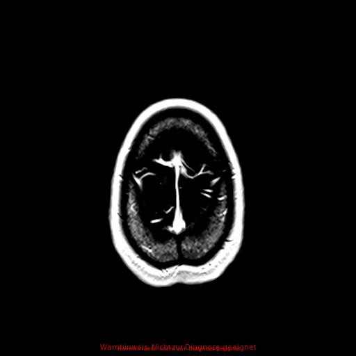 Normal adult brain MRI (non-enhanced and contrast-enhanced) (Radiopaedia 75262-86379 Axial T1 C+ 167).jpg