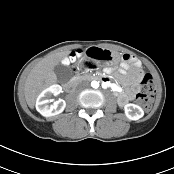 File:Normal multiphase CT liver (Radiopaedia 38026-39996 B 43).jpg