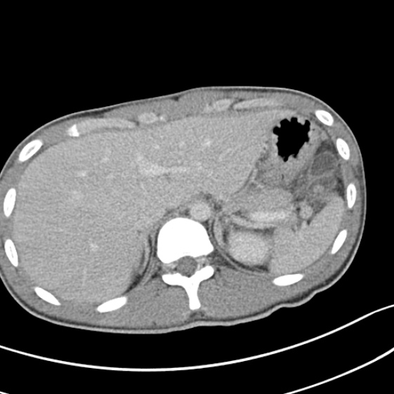 File:Acute appendicitis (Radiopaedia 32614-33572 Axial C+ portal venous phase 11).jpg