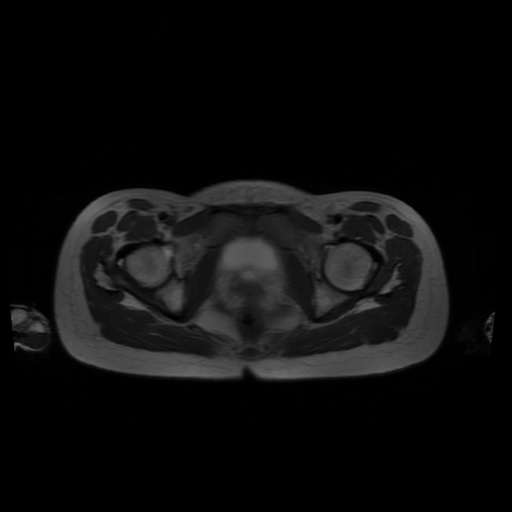 File:Normal MRI abdomen in pregnancy (Radiopaedia 88001-104541 Axial T2 69).jpg