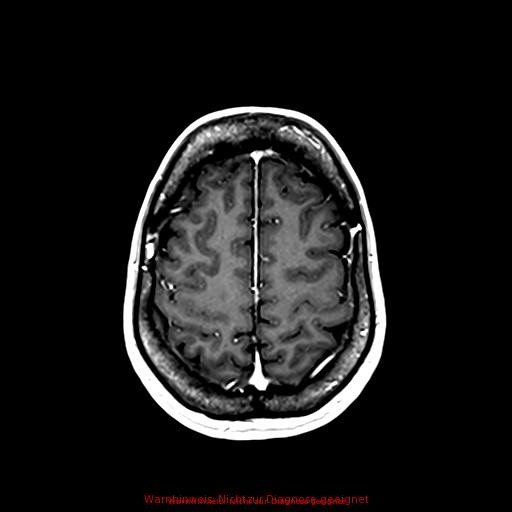 Normal adult brain MRI (non-enhanced and contrast-enhanced) (Radiopaedia 75262-86379 Axial T1 C+ 147).jpg
