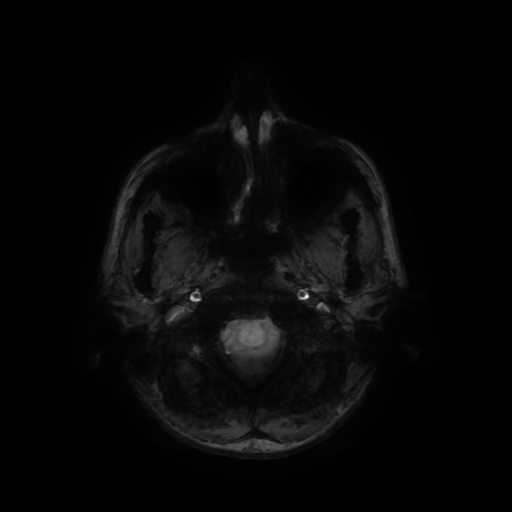 Normal noncontrast MR venography (Radiopaedia 87578-103957 Axial SWI 71).jpg