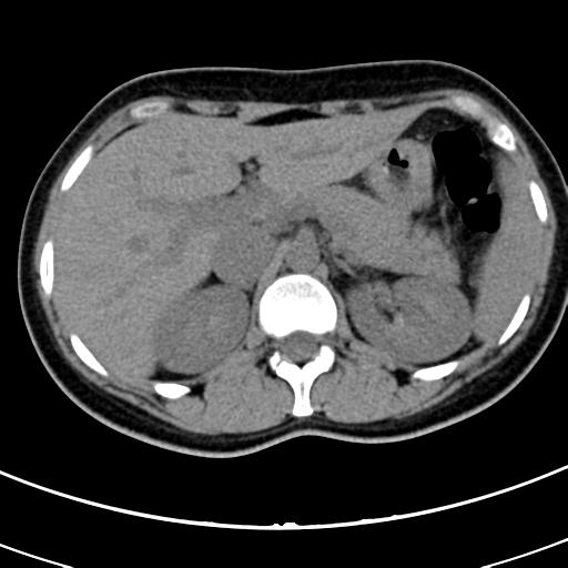 Acute appendicitis (Radiopaedia 30261-30888 Axial non-contrast 12).jpg