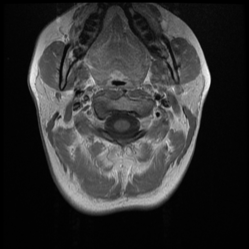 File:Normal cervical and thoracic spine MRI (Radiopaedia 35630-37156 Axial T1 C+ 29).png