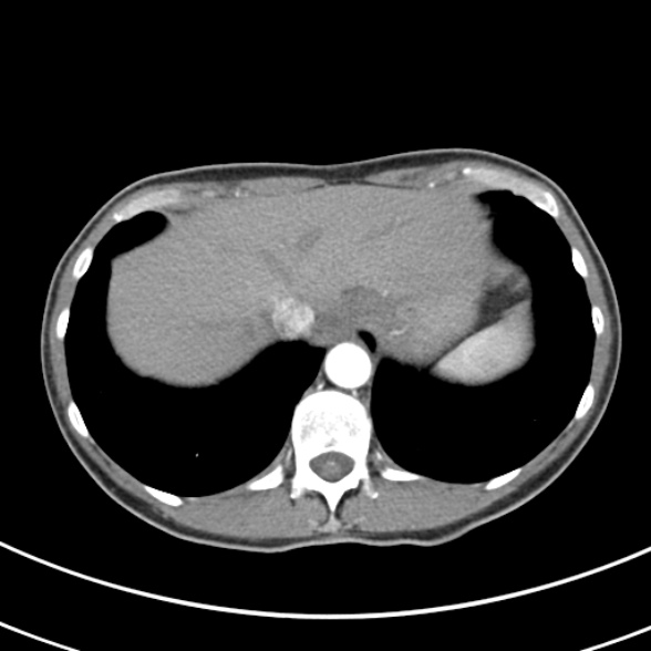File:Normal multiphase CT liver (Radiopaedia 38026-39996 B 10).jpg