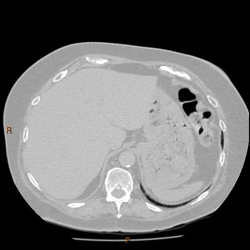 Azygos lobe (Radiopaedia 40161-42821 Axial lung window 66).jpg