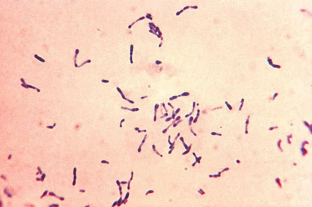 File:Corynebacterium diphtheriae Gram stain (DermNet NZ 640px-Corynebacterium diphtheriae Gram stain).jpg