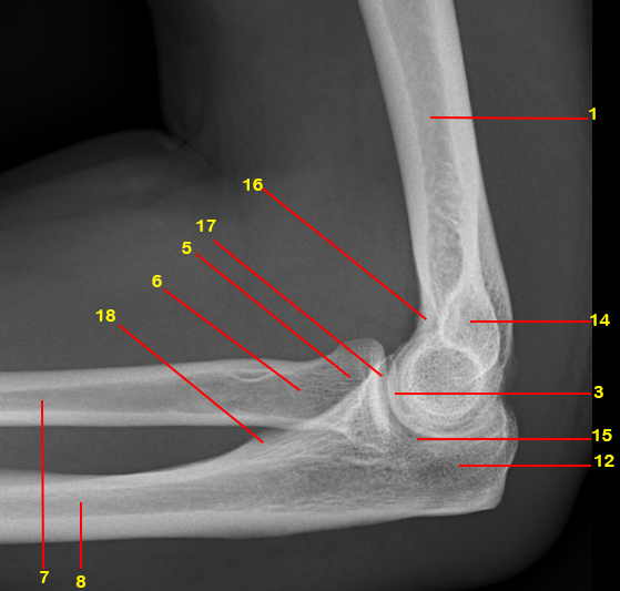 File:Normal radiographic anatomy of the elbow (Radiopaedia 42757-45918 Lateral 1).jpg