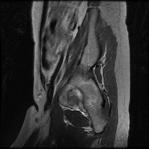 File:Normal female pelvis MRI (retroverted uterus) (Radiopaedia 61832-69933 Sagittal T2 4).jpg