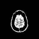 File:Neuro-Behcet's disease (Radiopaedia 21557-21505 Axial ADC 21).jpg