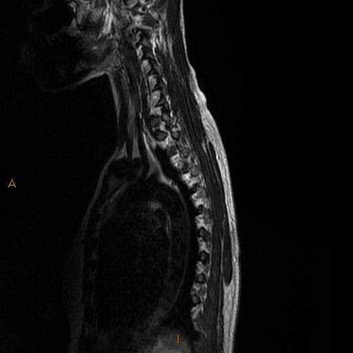 File:Normal spine MRI (Radiopaedia 77323-89408 E 12).jpg
