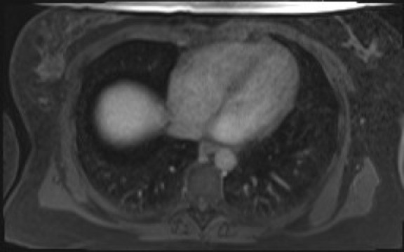 File:Normal hepatobiliary phase liver MRI (Radiopaedia 58968-66230 A 9).jpg