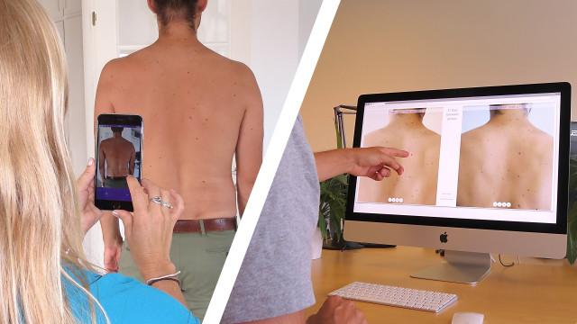 File:The Miiskin app being used to photograph a man’s back (DermNet NZ combi1).jpg