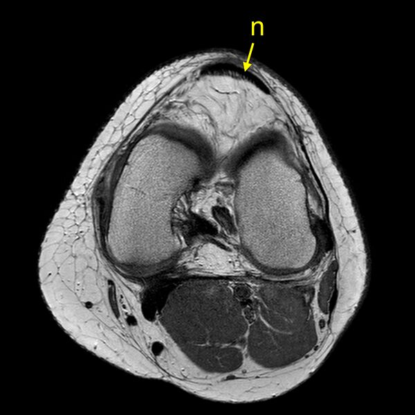 File:Anatomy Quiz (MRI knee) (Radiopaedia 43478-46866 A 15).jpeg