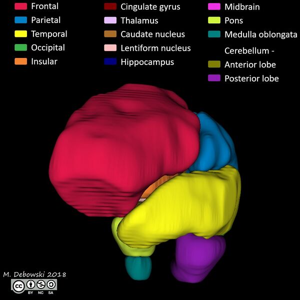 File:Brain lobes - annotated MRI (Radiopaedia 61691-69700 3D reconstruction 28).JPG