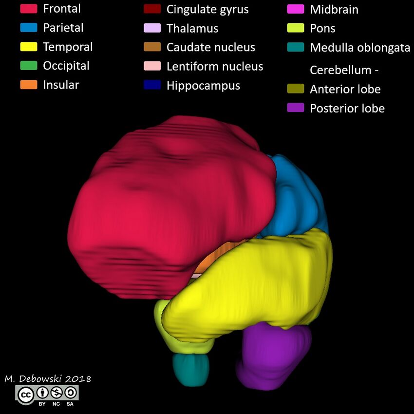 Brain lobes - annotated MRI (Radiopaedia 61691-69700 3D reconstruction 28).JPG