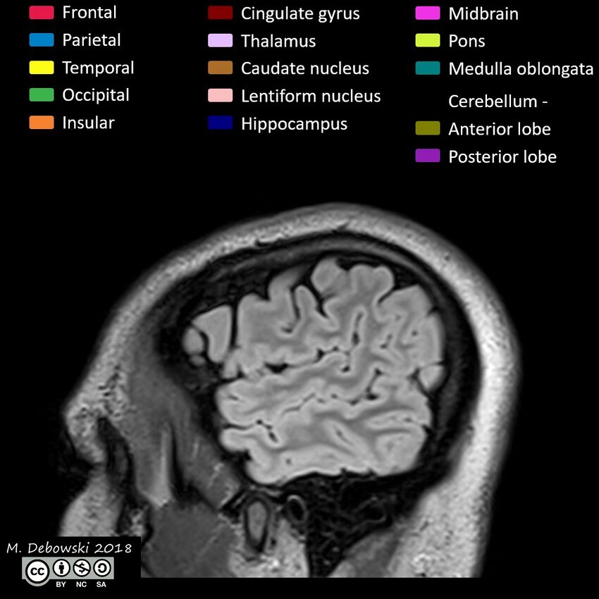 Brain lobes - annotated MRI (Radiopaedia 61691-69700 Sagittal 6).JPG
