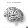 Neuroanatomy- lateral cortex (diagrams) (Radiopaedia 46670-51202 L 3).png