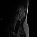 Normal spine MRI (Radiopaedia 77323-89408 Sagittal T2 15).jpg