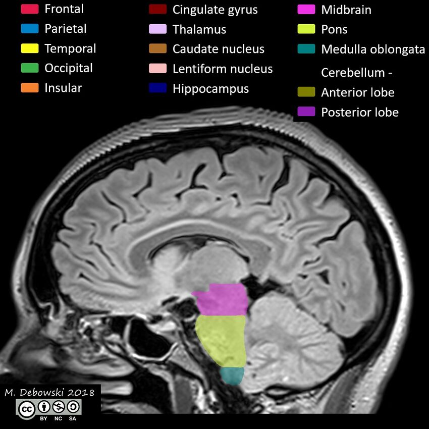 Brain lobes - annotated MRI (Radiopaedia 61691-69700 Sagittal 35).JPG
