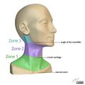 Neck trauma injury zones (diagram) (Radiopaedia 44651-48417 A 1).jpg