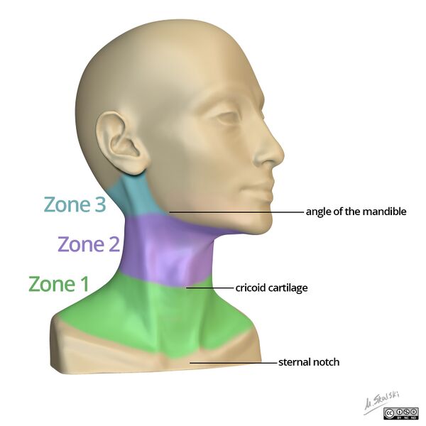 File:Neck trauma injury zones (diagram) (Radiopaedia 44651-48417 A 1).jpg