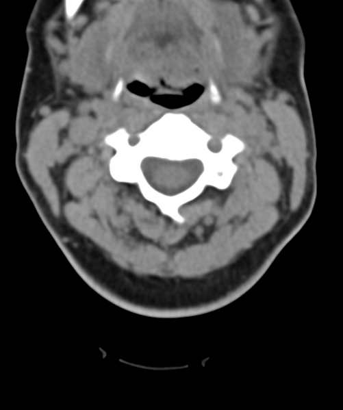 File:Normal cervical spine MRI (including Dixon) (Radiopaedia 42762-45926 Axial non-contrast 23).png