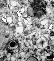 Transmission electron microscopy image of Vero cells infected with Zika virus