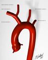 Aortic arch normal anatomy (illustration) (Radiopaedia 35949).jpg