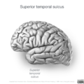 Neuroanatomy- lateral cortex (diagrams) (Radiopaedia 46670-51202 K 3).png