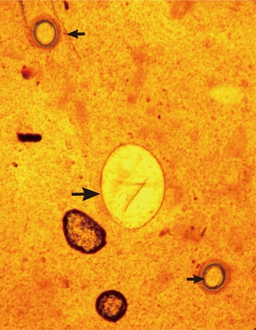 An Echinostoma ilocanum egg (larger arrow)