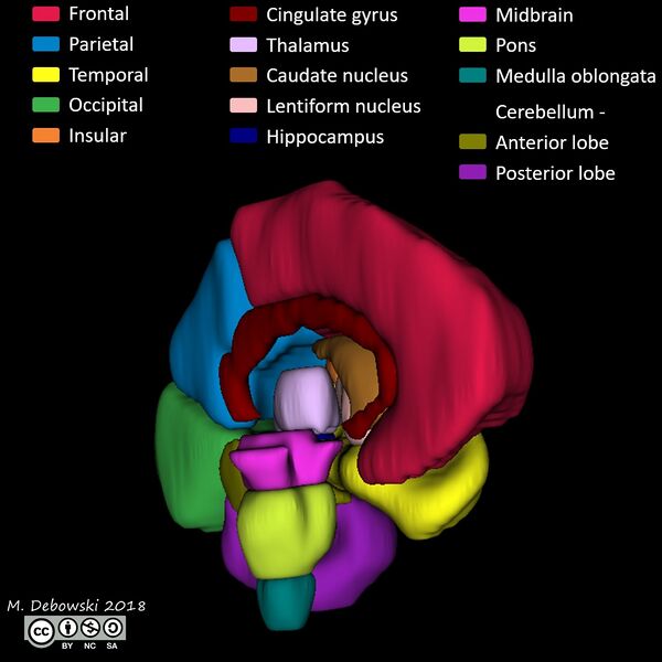 File:Brain lobes - annotated MRI (Radiopaedia 61691-69700 3D reconstruction 10).JPG