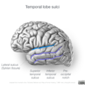 Neuroanatomy- lateral cortex (diagrams) (Radiopaedia 46670-51201 G 1).png
